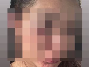 DJ Hits di Malang Raya Diduga Aniaya Kekasih, Korban Lapor Polisi