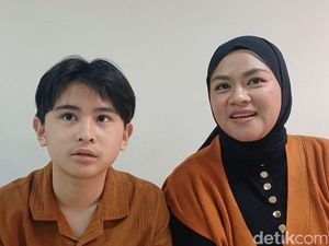 Potret Anak Daus Mini yang Menginjak Usia Remaja, Minat Jadi Vocalis Band