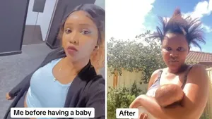 Before-After Melahirkan, Perjuangan Jadi Ibu Nggak Main-main!