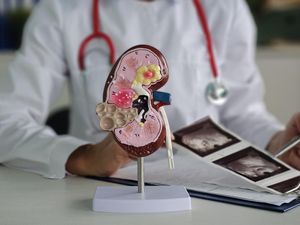 Kenapa Orang Baru Sadar Kena Penyakit Ginjal saat Kondisinya Parah? Ini Alasannya