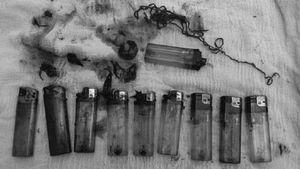 Bukan Photoshop, Penampakan Nyata 10 Korek Api Bersarang di Perut Pasien