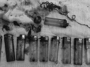 Bukan Photoshop, Penampakan Nyata 10 Korek Api Bersarang di Perut Pasien