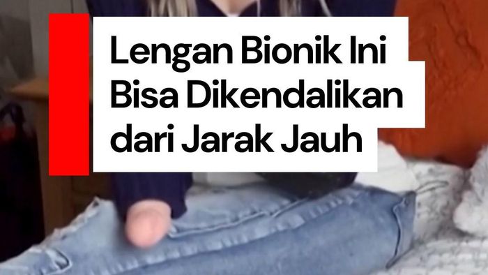 Video: Gadis Ini Punya Lengan Bionik yang Bisa Dikendalikan dari Jarak Jauh