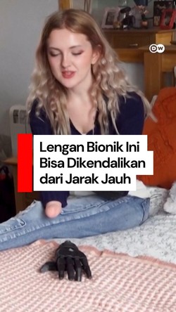 Video: Gadis Ini Punya Lengan Bionik yang Bisa Dikendalikan dari Jarak Jauh