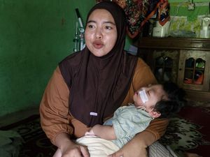 Sahabat Baik, Ayo Bantu Balita Zayn Sembuh dari Gangguan Otak Lissencephaly