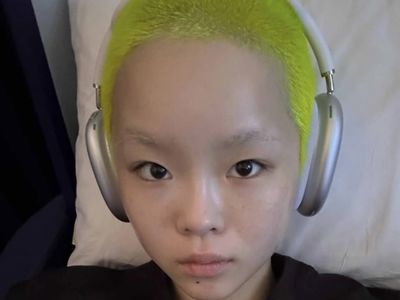 Before After Cocona XG Jalani Pengangkatan Payudara, Umumkan Identitas Baru