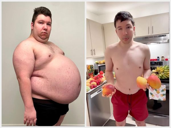 Potret Nikocado Avocado, Bintang Mukbang yang Pangling Usai Turun 113 Kg!