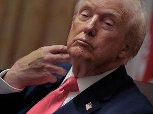 Tangan Trump Dipasangi Plester Luka, Gedung Putih Beri Penjelasan