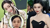 Wanita 37 Kali Oplas Demi Mirip Fan Bingbing, Akui Hidup Berubah & Menyesal