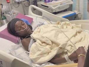 Supermodel Anok Yai Ungkap Penyakit Serius, Jalani Operasi Paru Robotik