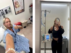 Cerita Gen Z Idap Kanker Payudara di Usia 24, Sudah Menopause di Umur 25