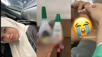 Viral Mau Pakai Tetes Mata Malah Tak Sengaja Ambil Lem, Endingnya Masuk RS