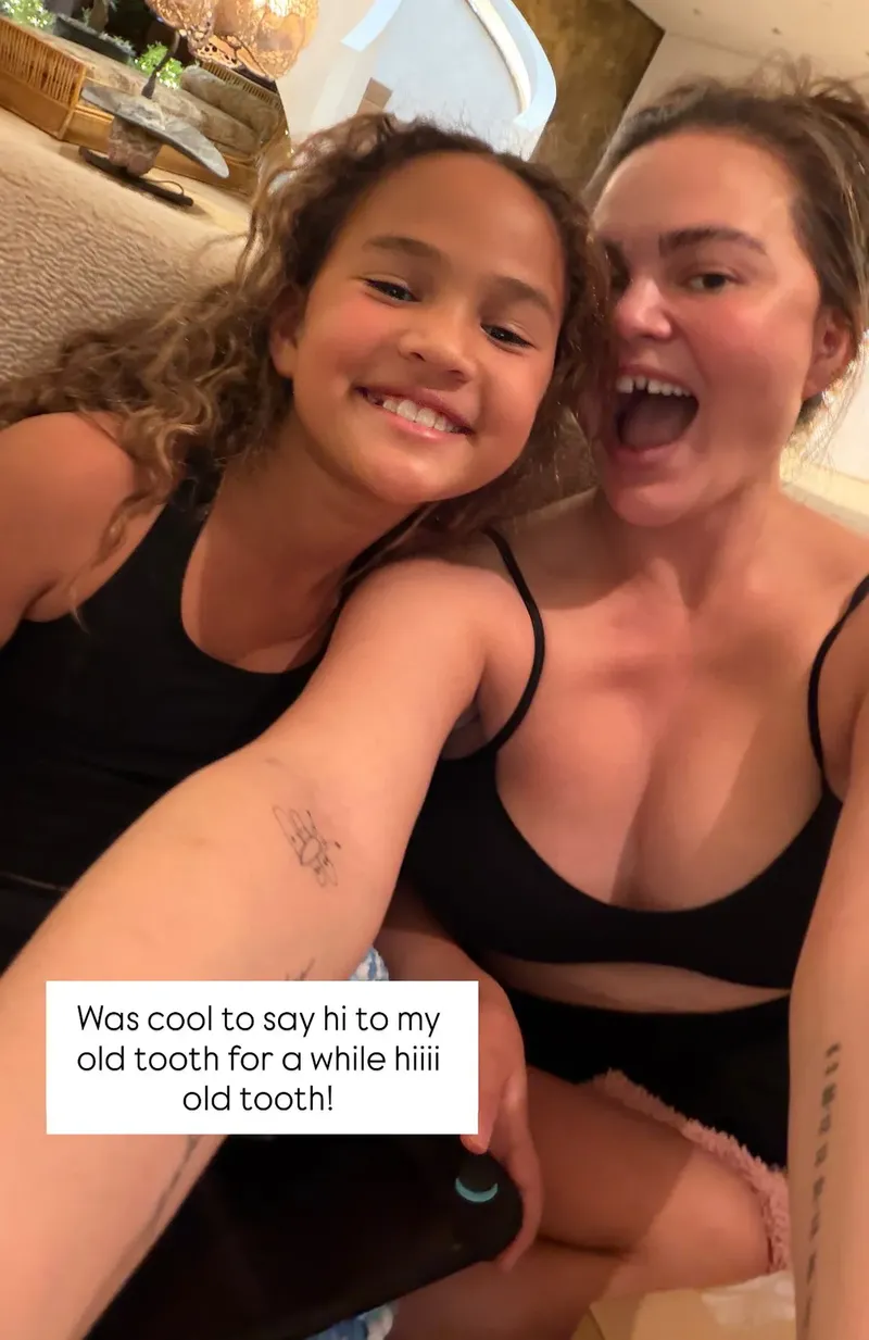 Waduh! Gigi Chrissy Teigen Copot Usai Gigit Permen Tongkat