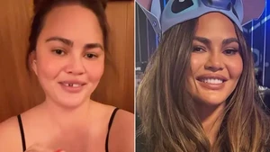 Waduh! Gigi Chrissy Teigen Copot Usai Gigit Permen Tongkat