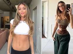 Tren Ozempic Body Makin Ekstrem, Kini Beralih ke Pengangkatan Tulang Rusuk