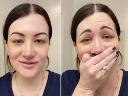Wanita Ini Kaget karena Efek Botox, Alis Jadi Melengkung Tak Wajar