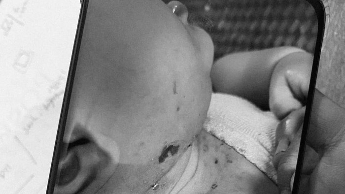 Polisi Berjaga 14 Jam di Aceh Tengah Usai Info Bayi Sakit Pascabencana