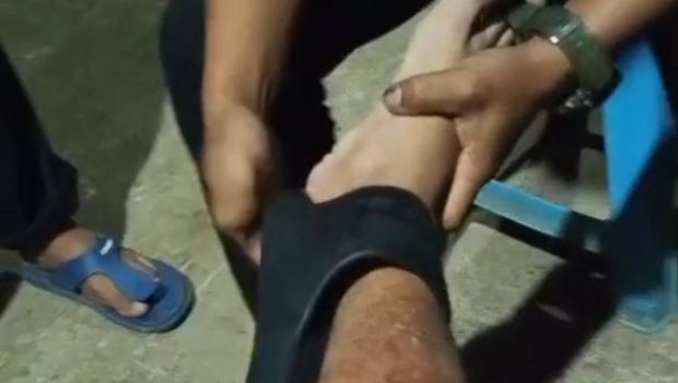 Sandalen stecken in seinen Waden, Mann in Pandeglang beschließt, zur Feuerwehr zu gehen