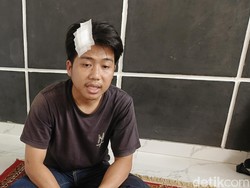 Polisi Sebut Pegawai Bank di Lampung Dianiaya karena Speaker