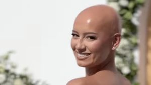 Potret Menyentuh Pengantin Wanita yang Tampil Botak di Hari Pernikahan