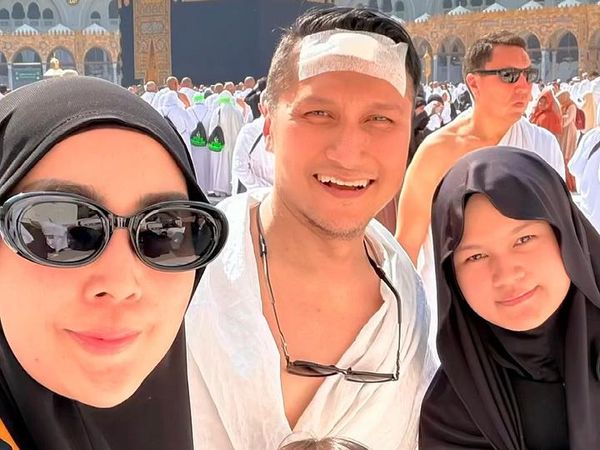 Arie Untung Alami Kepala Bocor di Arab