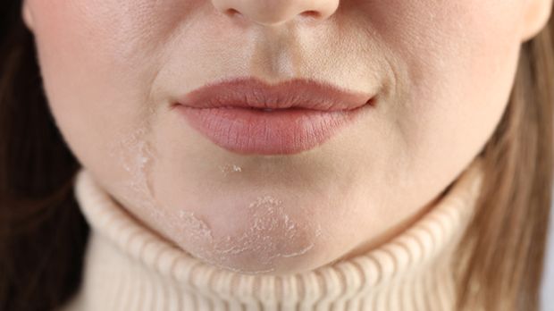 Dehidrasi dapat mengurangi elastisitas kulit dan membuatnya tampak lebih kering atau kusam