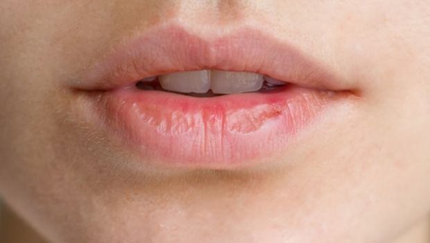 Cara membuat warna bibir lebih cerah adalah menghindari menjilati bibir yang mengelupas.