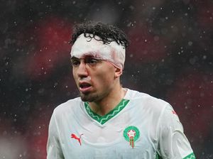 Momen Pemain Maroko Berdarah-Darah di Final Piala Afrika 2025