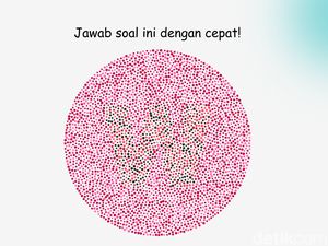 Tes Buta Warna, Bisa Lihat Huruf di Gambar Ini dan Tebak Jawabannya?