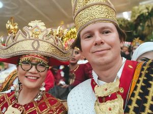 Suami Wamen Stella Lewati Masa Kritis, yang Dipikirkan Paper Fisika & AI