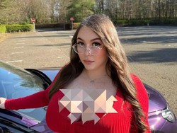 Derita Wanita dengan Payudara 25 Kg, Sakit Punggung hingga Alami Pelecehan