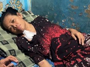 Kisah Ibu Siti Sholeha Pasien Gagal Ginjal, Berjuang Sembuh Demi Keluarga