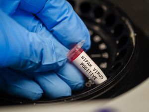 Apa Itu Virus Nipah yang Mewabah di India? Ini Gejala yang Harus Diwaspadai