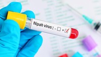 Telusuri Asal Virus Nipah, India Uji Kelelawar di Kebun Binatang