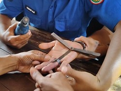 Ogah Operasi, Pria Pasuruan Minta Tolong Damkar Lepas Cincin di Jari