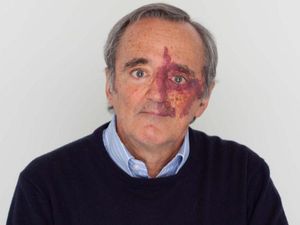 Dr Mariano Barbacid Jadi Sorotan, Ini Studinya yang Musnahkan Kanker Pankreas