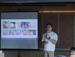 Gen Z Jangan Anggap Remeh, Kebiasaan Ini Diam-diam Picu Varises