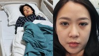 Wanita di Jaksel Kena Stroke di Usia 32 Tahun, Ini Gejala yang Dialami