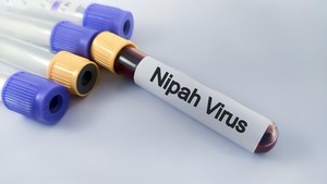 Kemenkes RI Keluarkan Edaran Waspadai Virus Nipah usai Mewabah di India