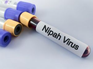 Kemenkes RI Keluarkan Edaran Waspadai Virus Nipah usai Mewabah di India
