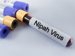 Kemenkes RI Keluarkan Edaran Waspadai Virus Nipah usai Mewabah di India