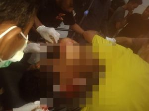 Pria di Bima Dibacok Berkali-kali Saat Jalan Kaki hingga Kritis