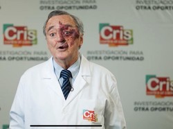 Viral Ilmuwan Spanyol Open Donasi demi Uji Klinis Kanker Pankreas, Butuh Segini