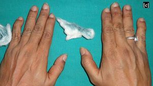 Foto: Dokter Tangani Pasien Berkeringat Hijau, Ternyata Ini Penyebabnya