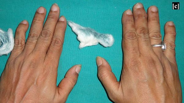 Foto: Dokter Tangani Pasien Berkeringat Hijau, Ternyata Ini Penyebabnya