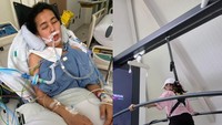 Kisah Wanita Jaksel Kena Tumor Otak di Usia 27, Ini Gejala Awalnya