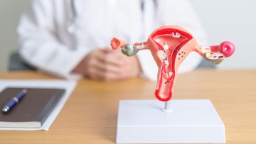 PCOS Berganti Nama Menjadi PMOS, Apa Bedanya? Ini Penjelasan Obgyn