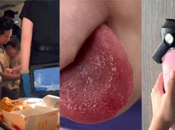 Ngeri! Lidah Bocah Ini Melepuh Gegara Pelayan Salah Kasih Air Panas