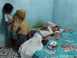 Perjuangan Ibu di Kulon Progo Rawat Nanda yang Lumpuh Usai Dipatuk Ular Weling