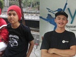 Kisah Haru Bayu, Survivor Kanker Anak yang Temukan Optimisme Sembuh di Tengah Perawatan